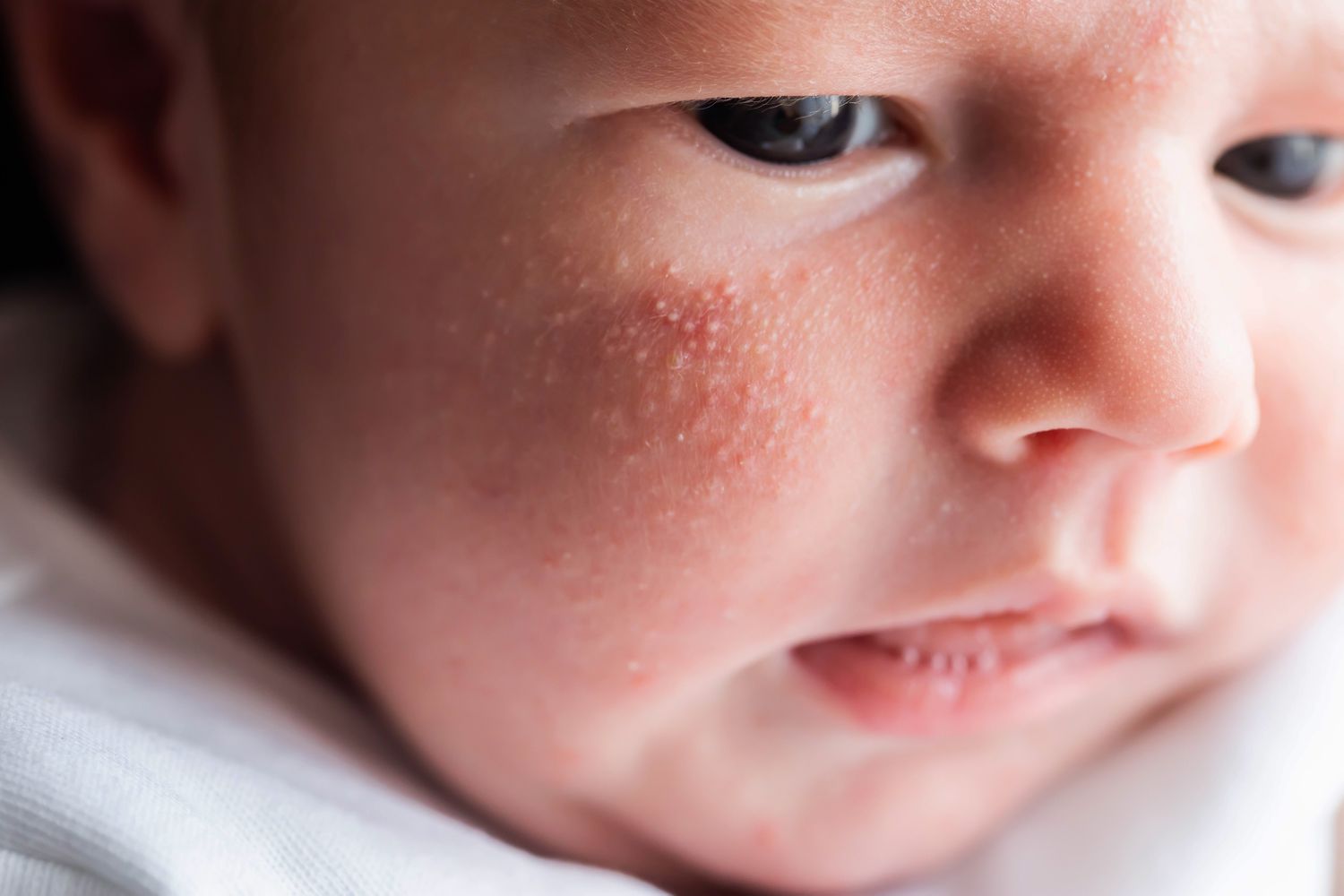 Close-up of a patient's skin showing irritation, used as an example of physical side effects requiring medical attention.