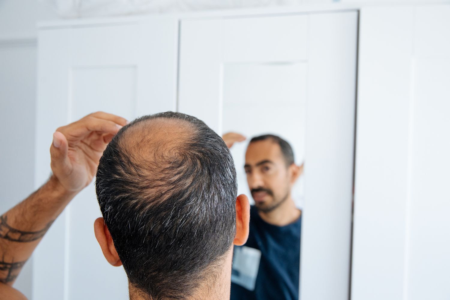 Minoxidil for Men: The Ultimate Hair Regrowth Guide