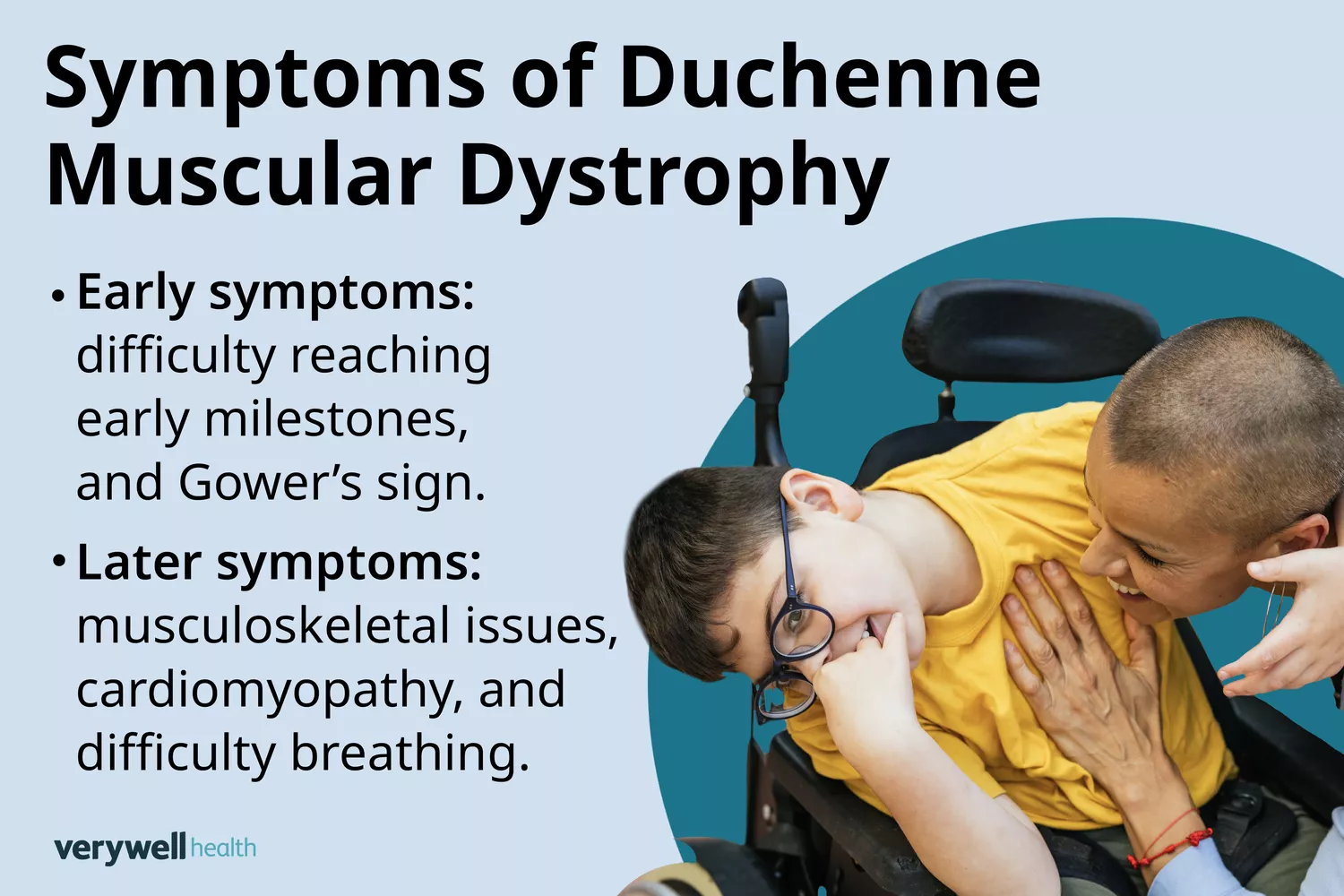 Infographic showing various physical symptoms of Duchenne Muscular Dystrophy in children.