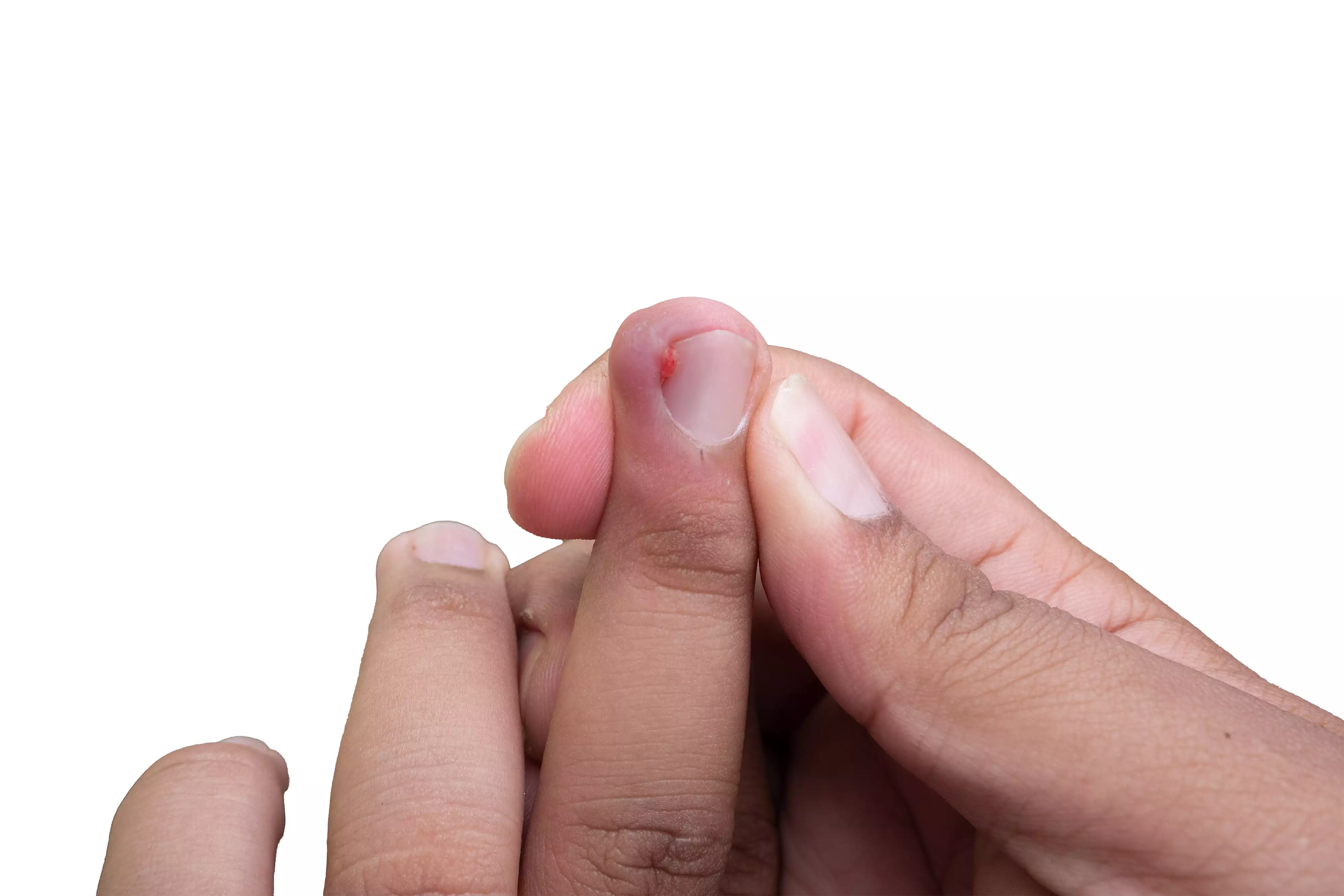 Visible clinical signs of physiological stress.